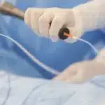 12 قسطرة القلب من اليد